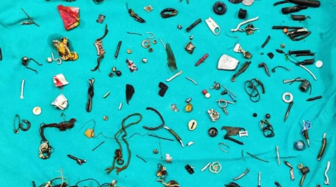 Γιατροί στην Ινδία έβγαλαν από το έντερο άνδρα 60 αντικείμενα - Τους είπε πως είχε στομαχόπονο