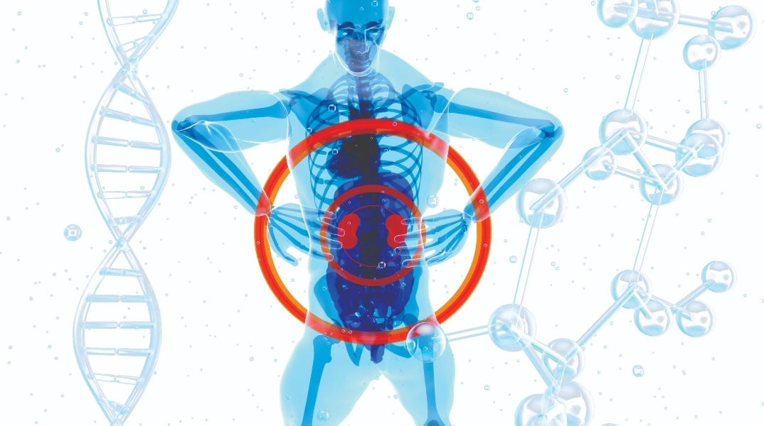 Χρόνια Νεφρική Νόσος: Η σημασία της διάγνωσης