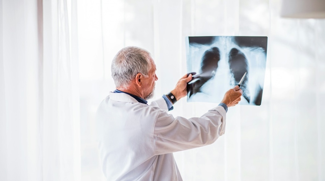 Ιατρός εξετάζει ακτινογραφία στην οποία διακρίνονται οι πνεύμονες