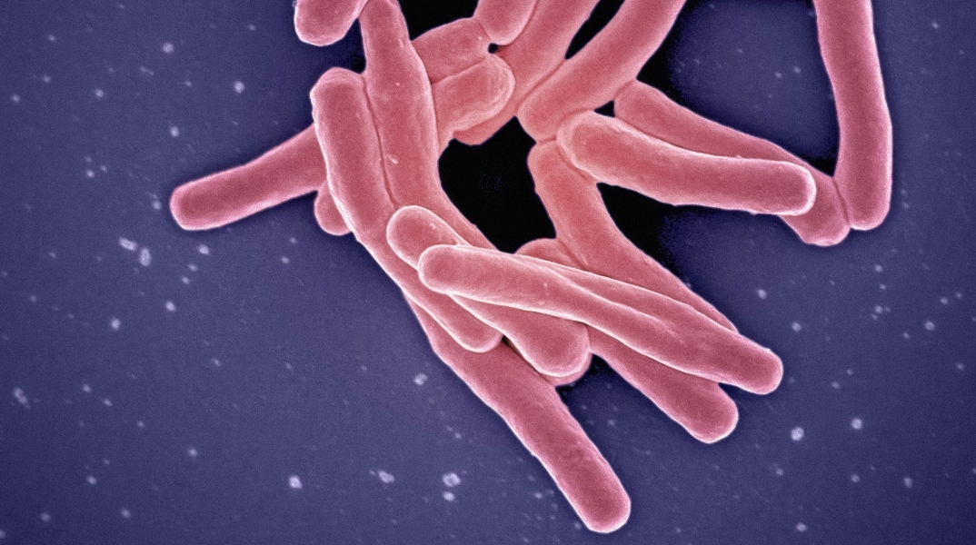 24 Μαρτίου, Παγκόσμια Ημέρα Φυματίωσης 2024