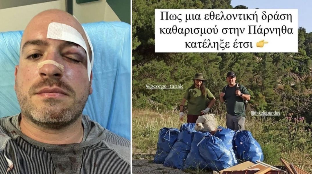 Άγνωστοι επιτέθηκαν και μαχαίρωσαν εθελοντές που καθάριζαν την Πάρνηθα - Η καταγγελία τους και τα ντοκουμέντα του αιματηρού επεισοδίου