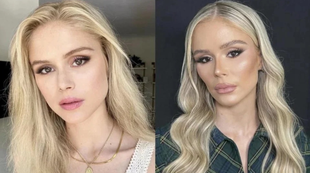 Σχόλιο για τις πλαστικές επεμβάσεις