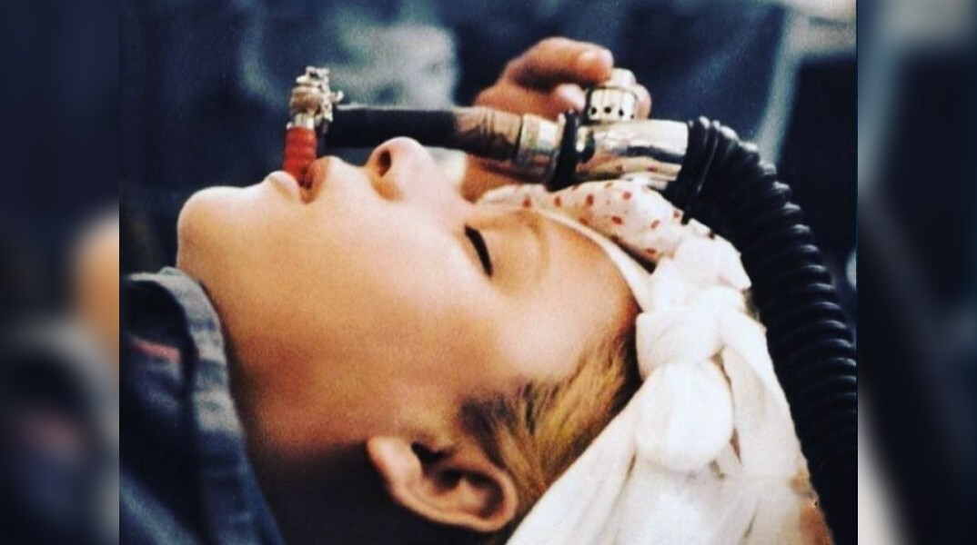 Αλίκη Βουγιουκλάκη: Σπάνια φωτογραφία της από το χειρουργείο