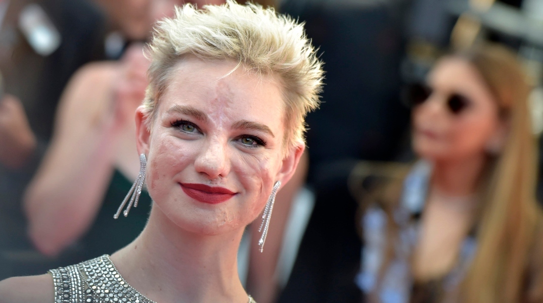 H Bebe Vio, παραολυμπιονίκης ξιφασκίας μιλά για την ορατότητα των ΑμΕΑ