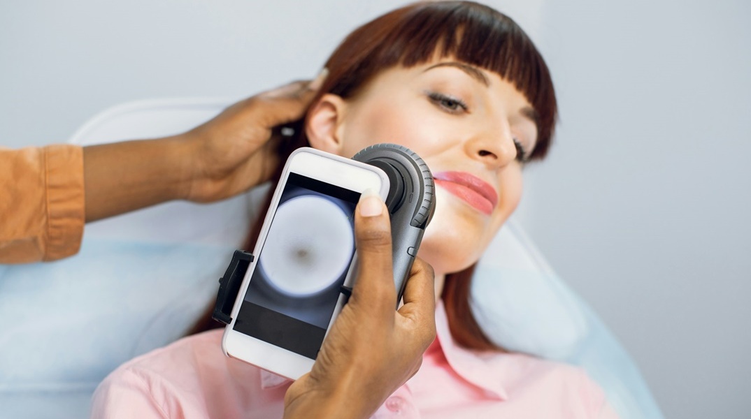 Έλεγχος για τον καρκίνο του δέρματος