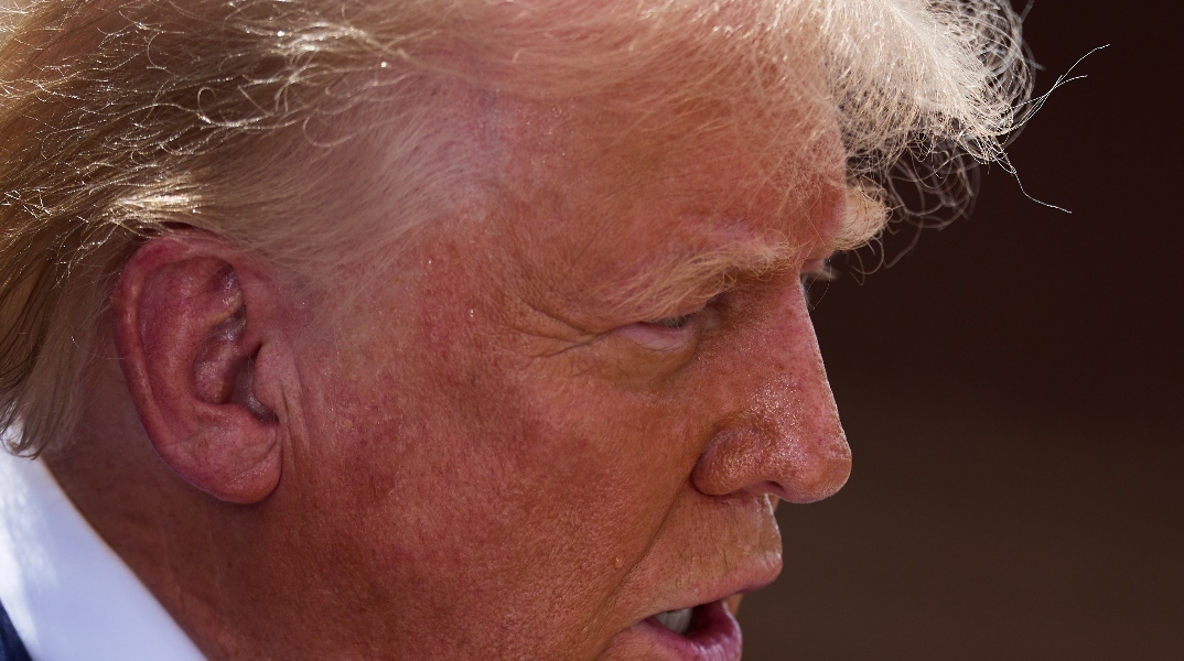 Υπάρχει λόγος που τα μαλλιά του Τραμπ αλλάζουν... χρώμα 