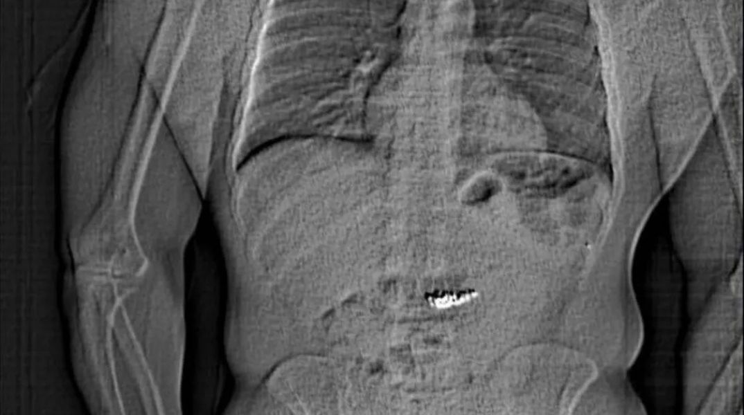 ΗΠΑ: Άνδρας κατάπιε κλεμμένα σκουλαρίκια Tiffany αξίας 769.500 δολαρίων λίγο πριν τη σύλληψή του - Εκκρεμούν 48 εντάλματα σύλληψης εναντίον του