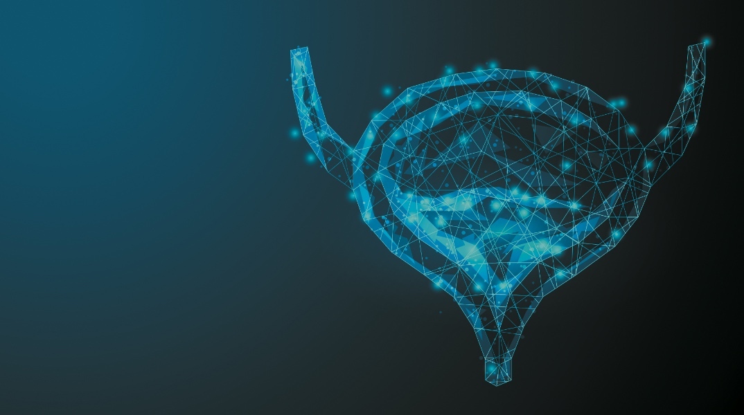 Αναίμακτη θεραπεία καρκίνου του προστάτη  