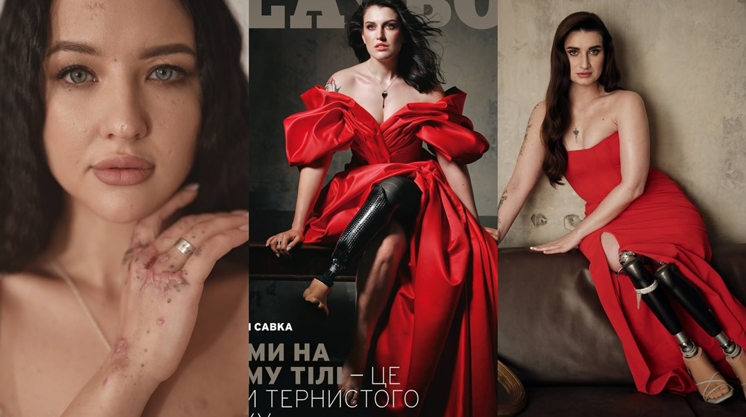 Ουκρανές που τραυματίστηκαν ή ακρωτηριάστηκαν στον πόλεμο φωτογραφίζονται για το Playboy και στέλνουν το μήνυμά τους