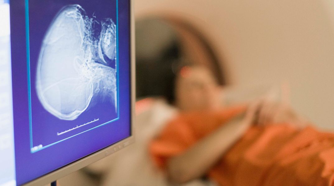 Νέα Υόρκη: 61χρονος πέθανε όταν μπήκε στον χώρο μαγνητικής τομογραφίας φορώντας βαριά μεταλλική αλυσίδα - Η σύζυγός του περιγράφει το σοκαριστικό περιστατικό