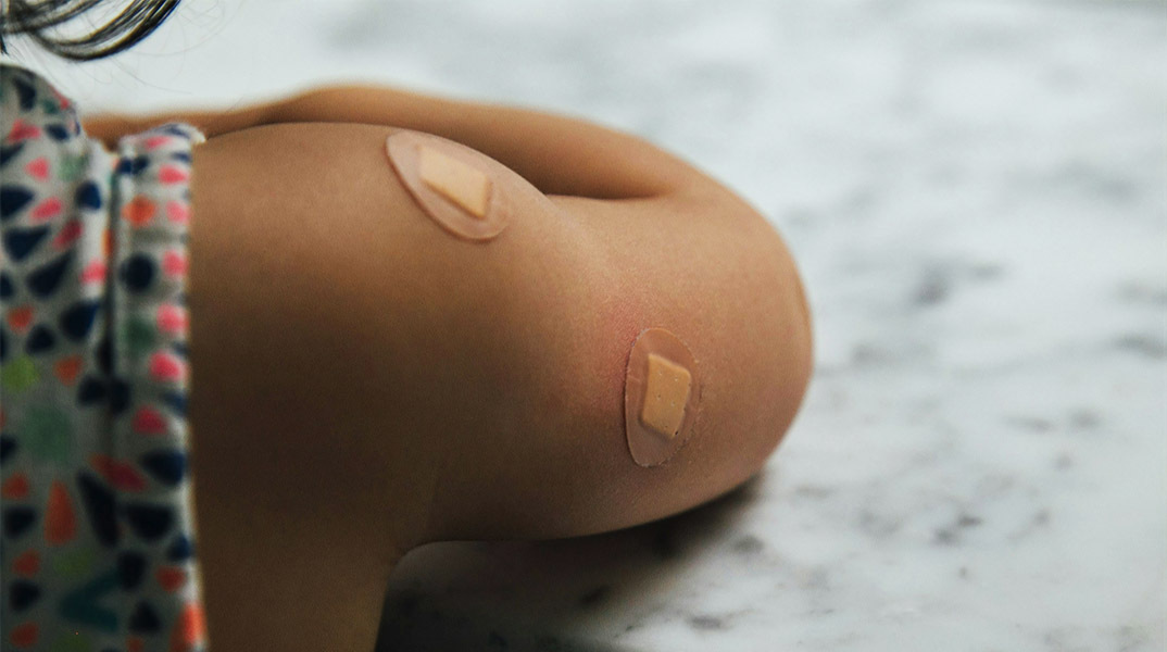 Πότε κινδυνεύουν τα μωρά από το τσίμπημα κουνουπιού;