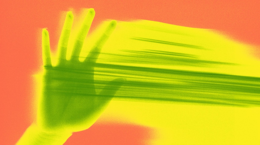 Πεθαίνω, με βλέπεις;