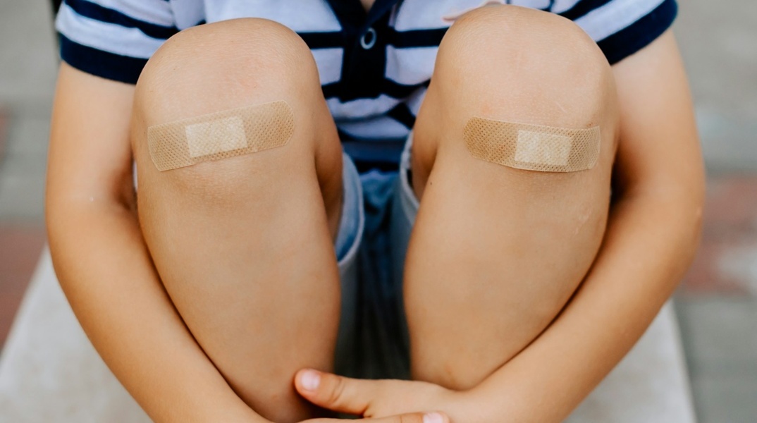 Παιδί με πληγές καλυμμένες με χάνσαπλαστ