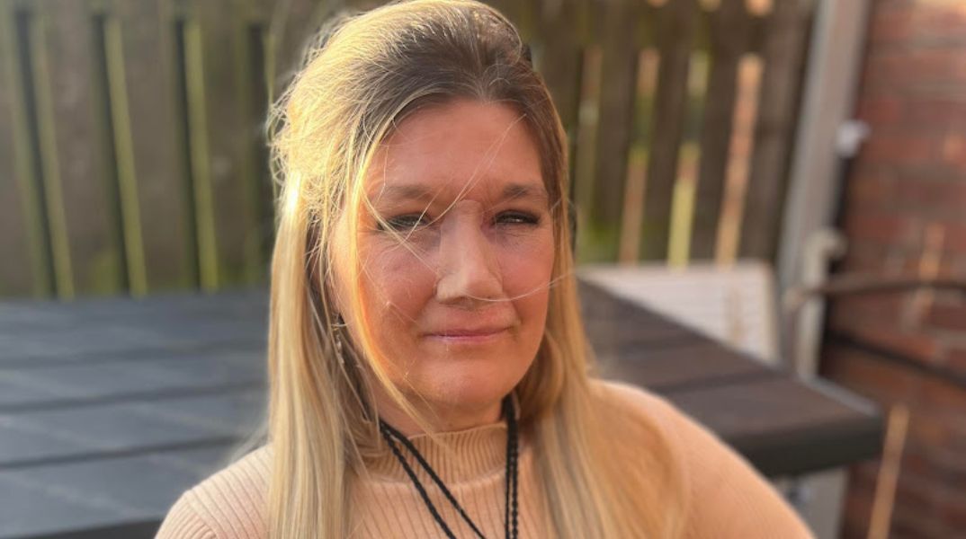 Ηνωμένο Βασίλειο: Η Έλεν ΜακΚλίρι, 46 ετών, έχασε τη μύτη της λόγω καρκίνου που αρχικά διαγνώστηκε λανθασμένα ως αλλεργία - Σήμερα ζει με προσθετική μύτη.