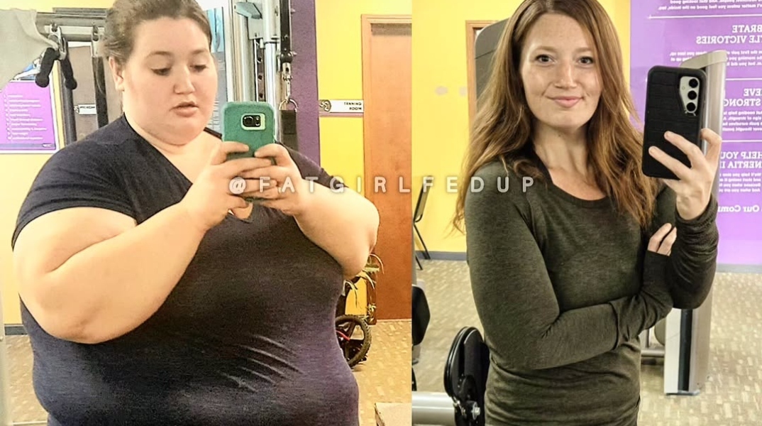 Η μάχη μιας influencer με τα κιλά και μία σπάνια ασθένεια 