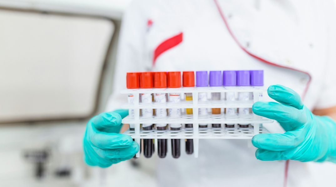 Βρετανοί επιστήμονες ανέπτυξαν την πρώτη ακριβή εξέταση αίματος για το σύνδρομο χρόνιας κόπωσης, προσφέροντας ελπίδα για έγκαιρη διάγνωση.