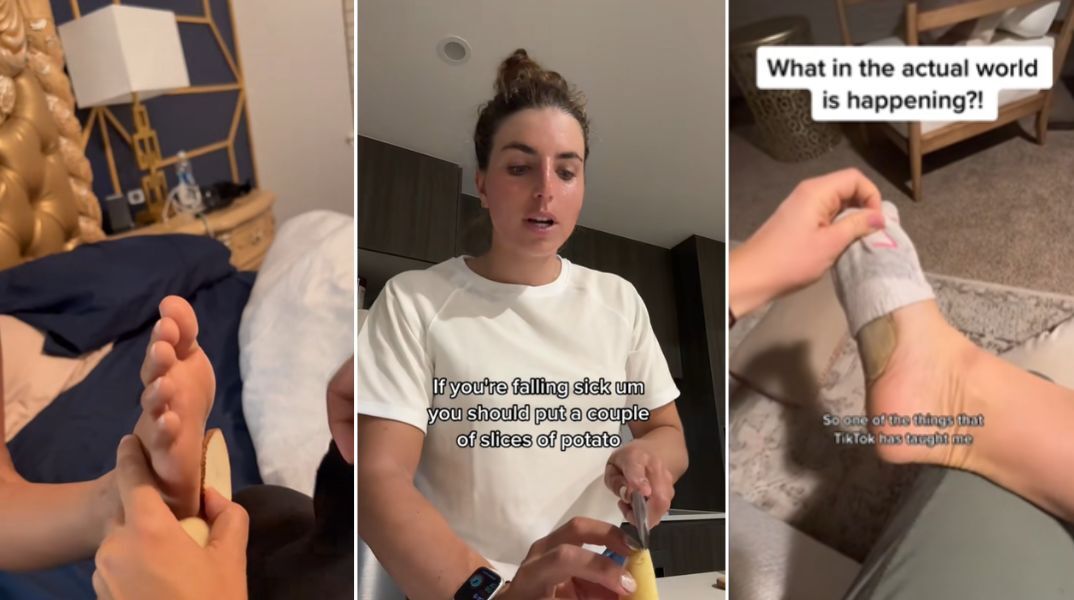 Χιλιάδες χρήστες βάζουν φέτες πατάτας στις κάλτσες πριν τον ύπνο πιστεύοντας ότι αποτοξινώνουν τον οργανισμό - Οι γιατροί διαψεύδουν τον «θαυματουργό» μύθο.