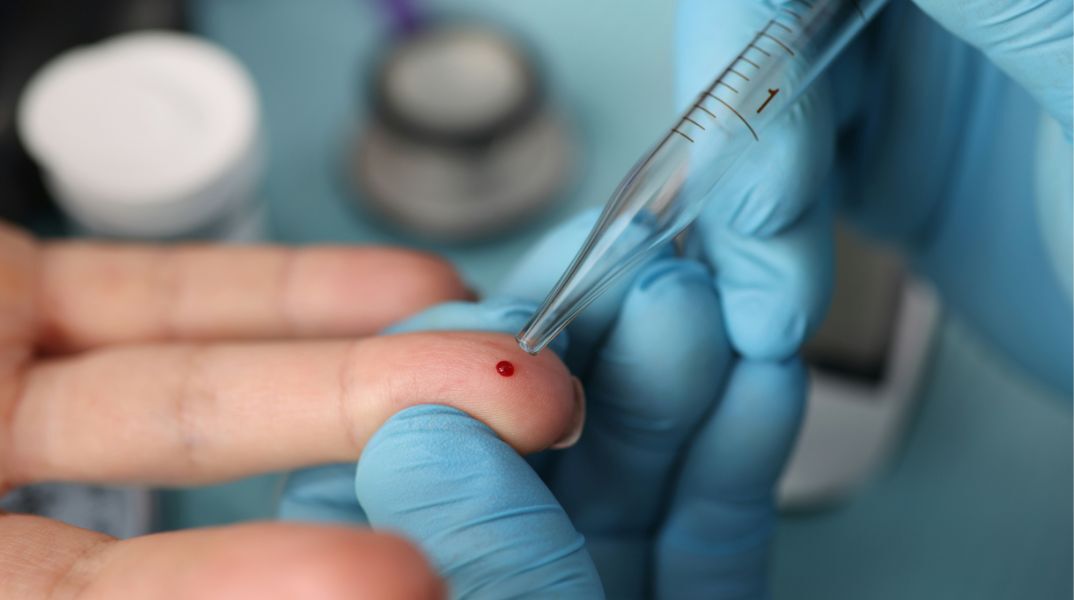 Νέα τεστ με σταγόνα αίματος προβλέπουν ασθένειες έως και 10 χρόνια πριν τα συμπτώματα, αλλάζοντας τον χάρτη της πρόληψης στην υγεία.