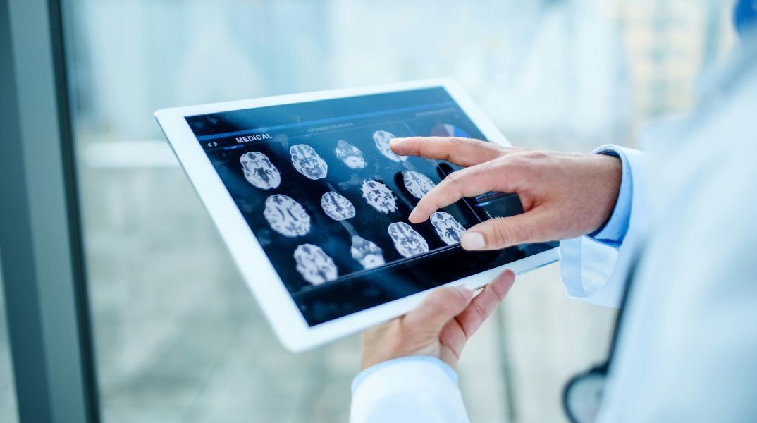 Μελέτη του Πανεπιστημίου Κέιμπριτζ: Ο εγκέφαλος μένει σε εφηβική φάση έως τα 32, με κρίσιμες αλλαγές στα 9, 32, 66 και 83 έτη.