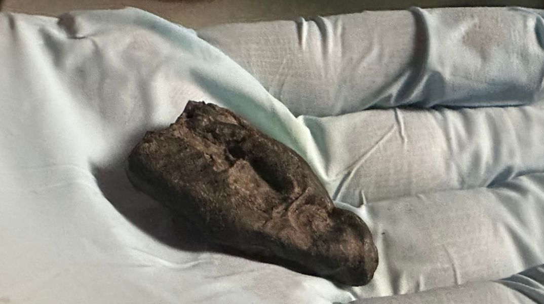 Αρχαίο DNA: Έφηβη μάσησε «τσίχλα» από φλοιό πριν από 10.500 χρόνια στην Εσθονία - Επιστήμονες ανέλυσαν ρητίνη σημύδας με αποτυπώματα δοντιών 