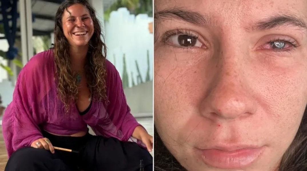 Η νεαρή μοιράστηκε την περιπέτεια με την απώλεια της όρασής της στα social media