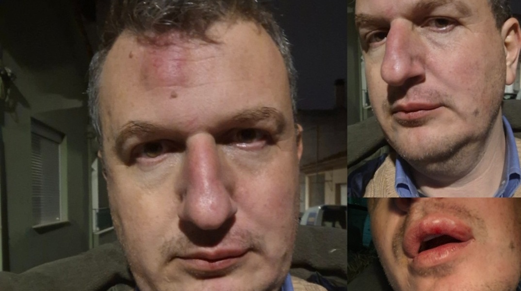 Μαγνησία: Εκδότης έπεσε θύμα άγριου ξυλοδαρμού έξω από το σπίτι του