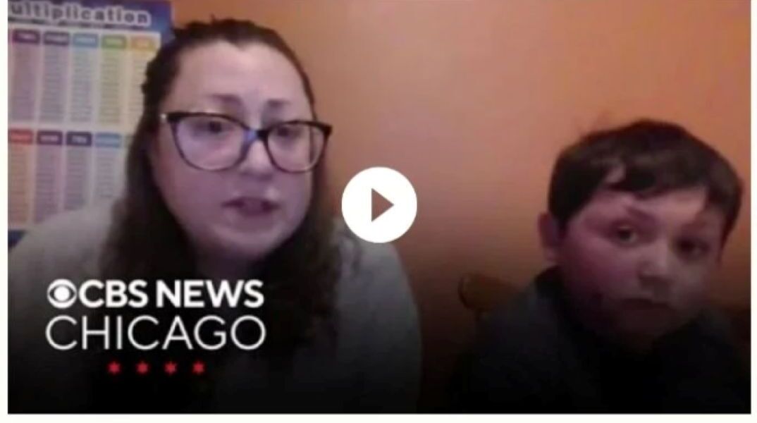 O 9χρονος που υπέστη σοβαρά εγκαύματα δοκιμάζοντας επικίνδυνο διαδικτυακό trend