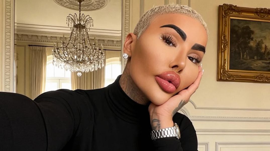 Πέθανε ο Τζόρνταν Τζέιμς Παρκ, γνωστός για τις πλαστικές του επεμβάσεις με στόχο να μοιάσει στην Κιμ Καρντάσιαν - Ήταν υπόδικος για ανθρωποκτονία