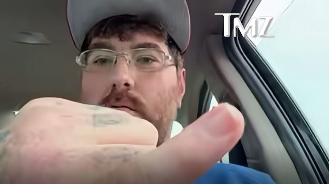 Αμερικανός με διάγνωση μικροφαλλίας προκαλεί να διαψευστεί ο ισχυρισμός του για το «μικρότερο πέος στον κόσμο» και ζητά ευαισθητοποίηση για τη σπάνια πάθηση.