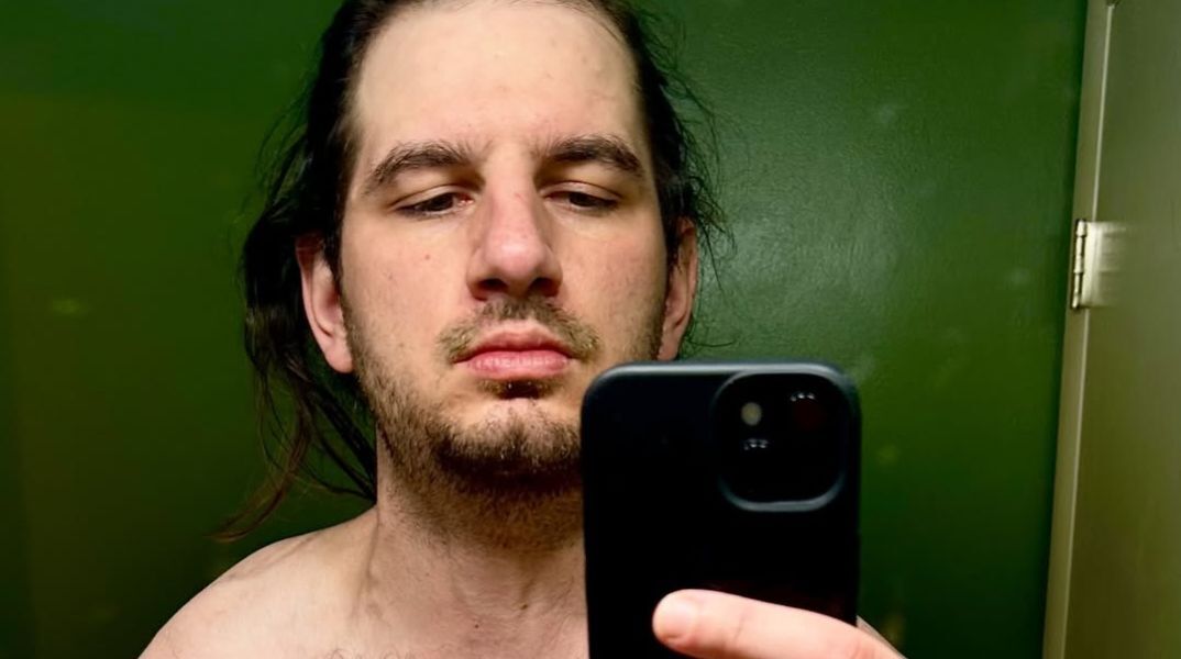 Influencer παίρνει στεροειδή και πίνει 24 μπίρες καθημερινά χωρίς να γυμνάζεται, αποκαλύπτοντας τις σοκαριστικές παρενέργειες στο σώμα του.