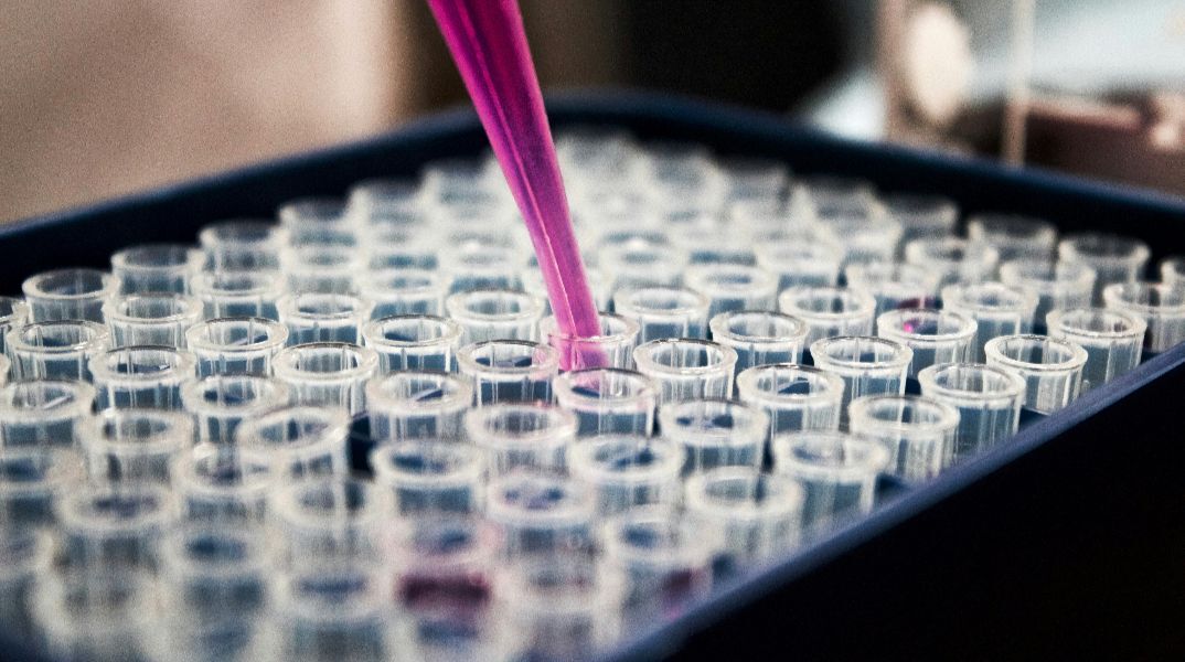 Εμβόλιο κατά του καρκίνου: Τι λένε ειδικοί για την καινοτόμα θεραπεία που μικραίνει τους όγκους 