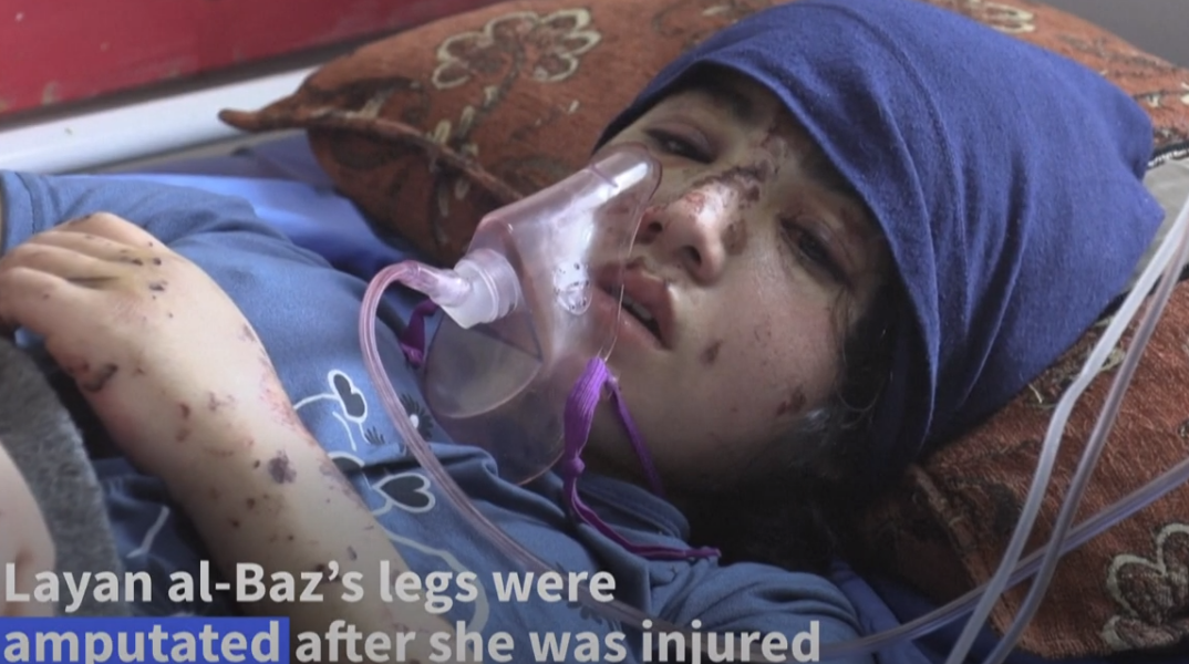 Η 13χρονη έχασε και τα δύο της πόδια μετά από βομβαρδισμό στη Γάζα