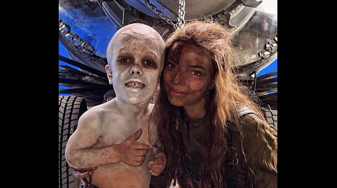 Quaden Bayles: Το αγόρι με νανισμό στα γυρίσματα της ταινίας Furiosa