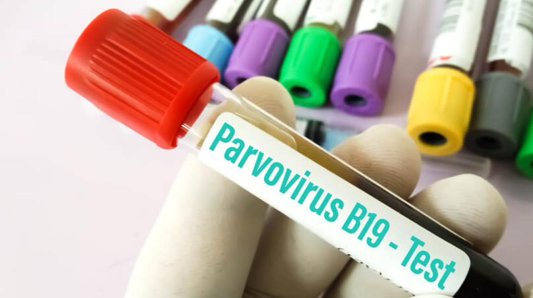 Παρβοϊοί: Μύθοι και αλήθειες για τη μετάδοσή τους 