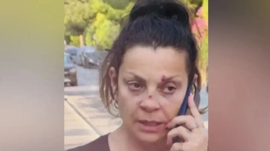 Πρώην σύζυγος Στάθη Αγγελόπουλου: Δεν είμαι τρελή να χτυπάω το κεφάλι μου στον τοίχο