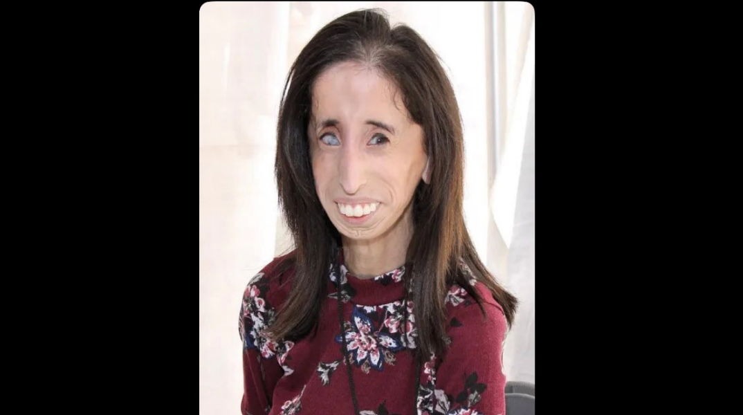 lizzie