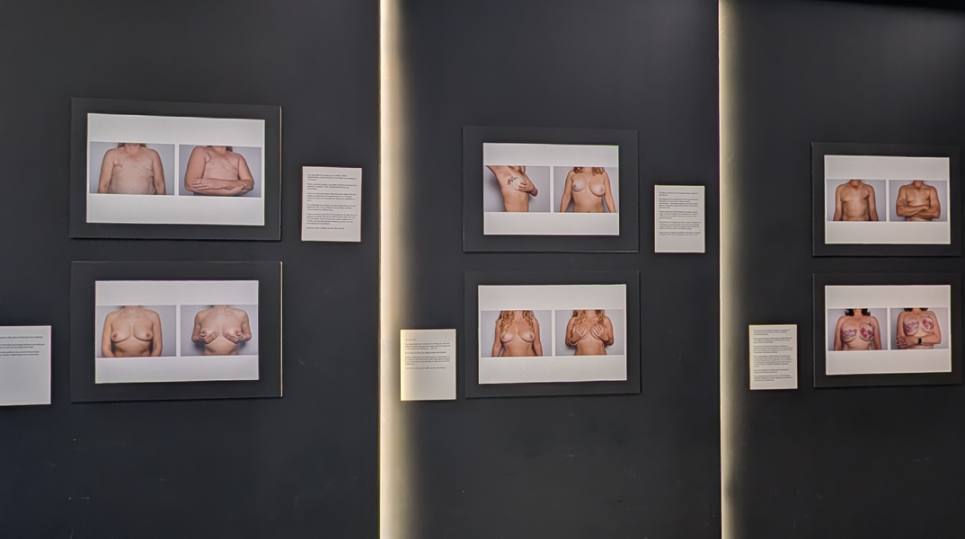 Σύλβια Κουβέλη: «Θέλω οι εκθέσεις του boobs να γίνουν αφορμή για να ανοίξει μια δύσκολη συζήτηση»