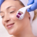 Derma Rolling: Λειτουργεί τελικά ή χαλάμε τζάμπα το δέρμα μας;