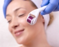 Derma Rolling: Λειτουργεί τελικά ή χαλάμε τζάμπα το δέρμα μας;