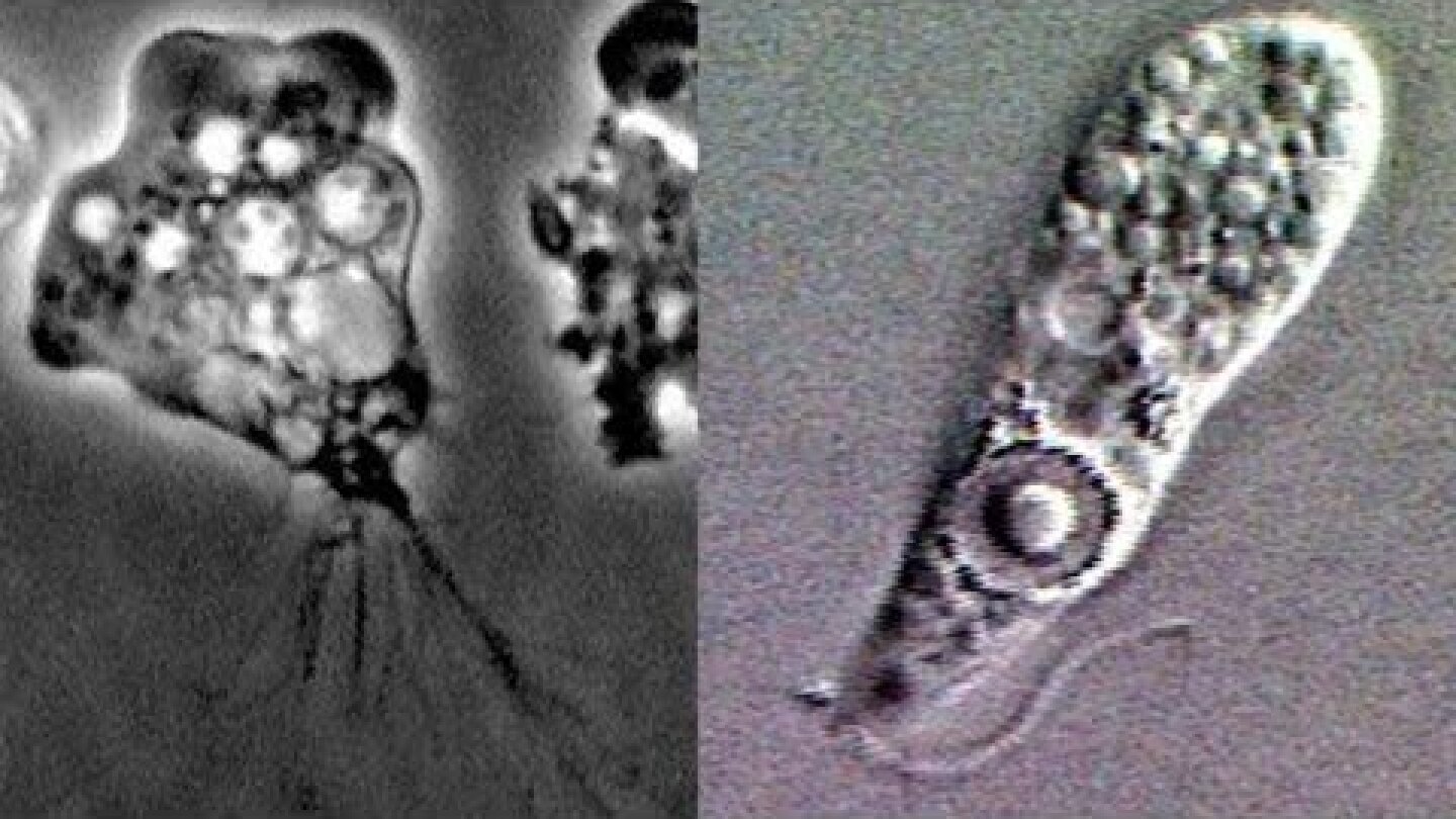 Brain eating amoeba, Naegleria fowleri, found in Missouri resident after trip to the Ozarks