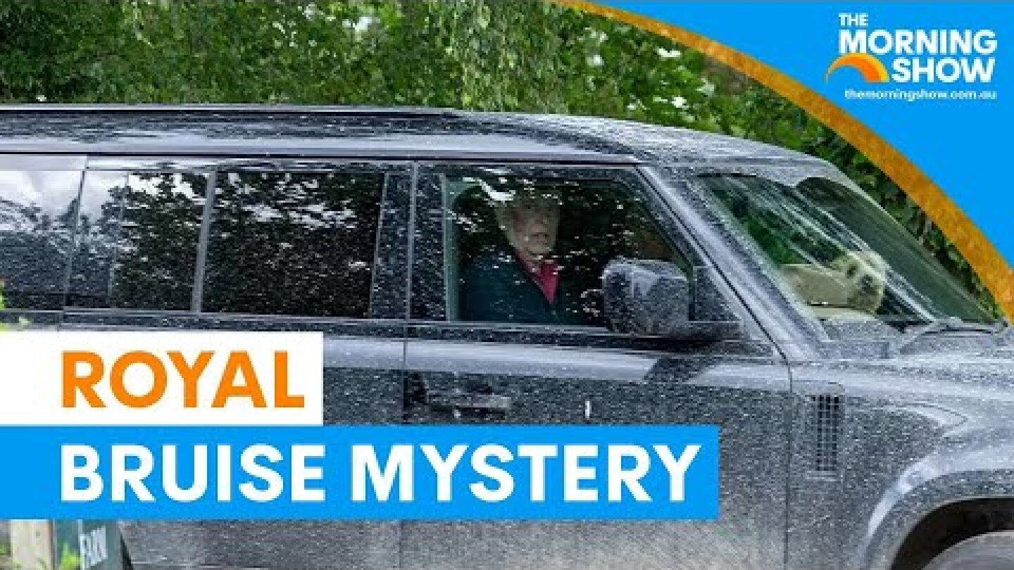 Prince Andrew's bruise sparks speculation | The Morning Show