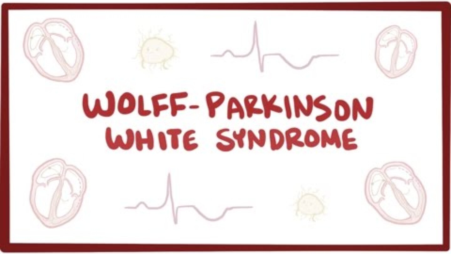 Wolff-Parkinson-White syndrome (WPW) - causes, symptoms & pathology