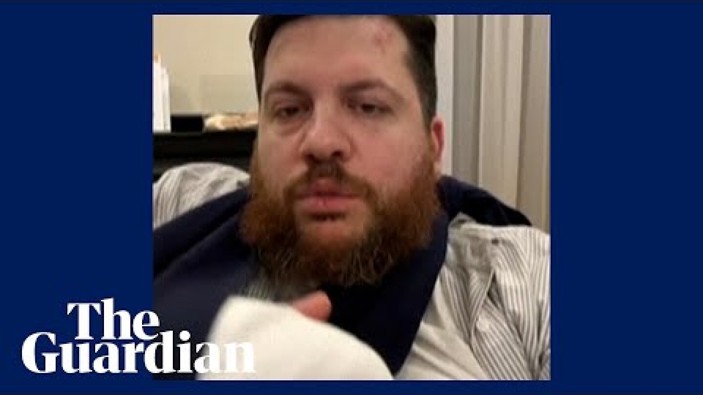 Navalny ally vows to keep fighting Putin after hammer attack