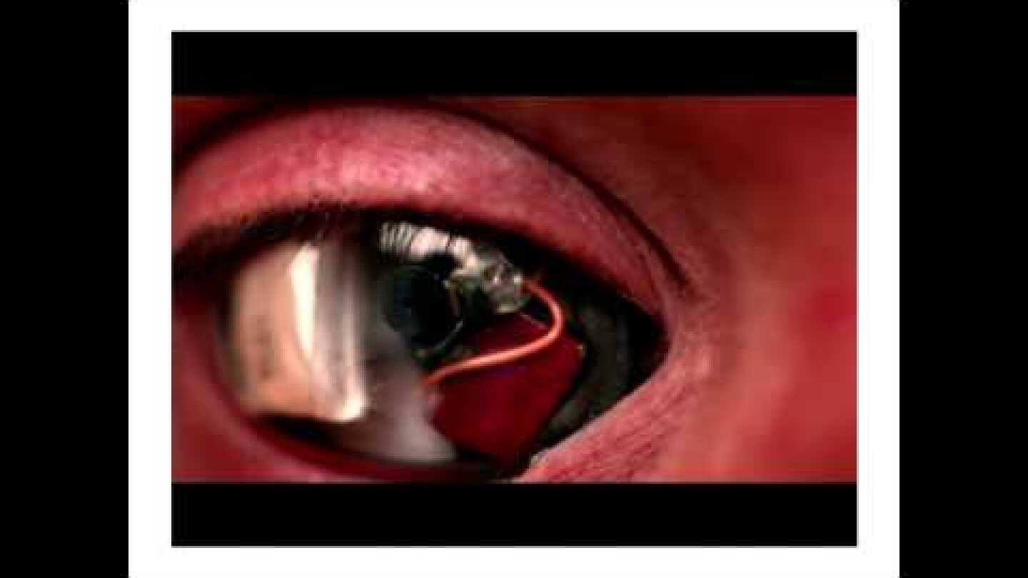 TEDXBrussels - Rob Spence - Eyeborg, the Enhanced Self