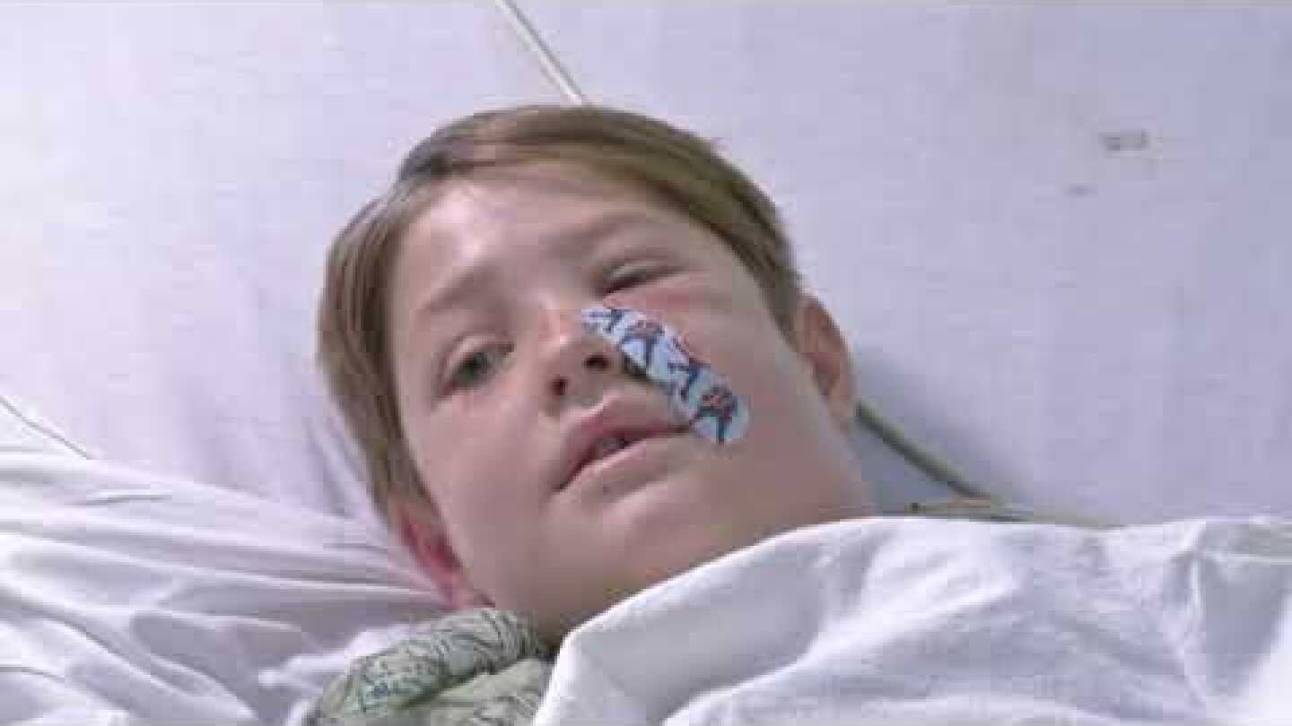 Boy survives after meat skewer runs through skull