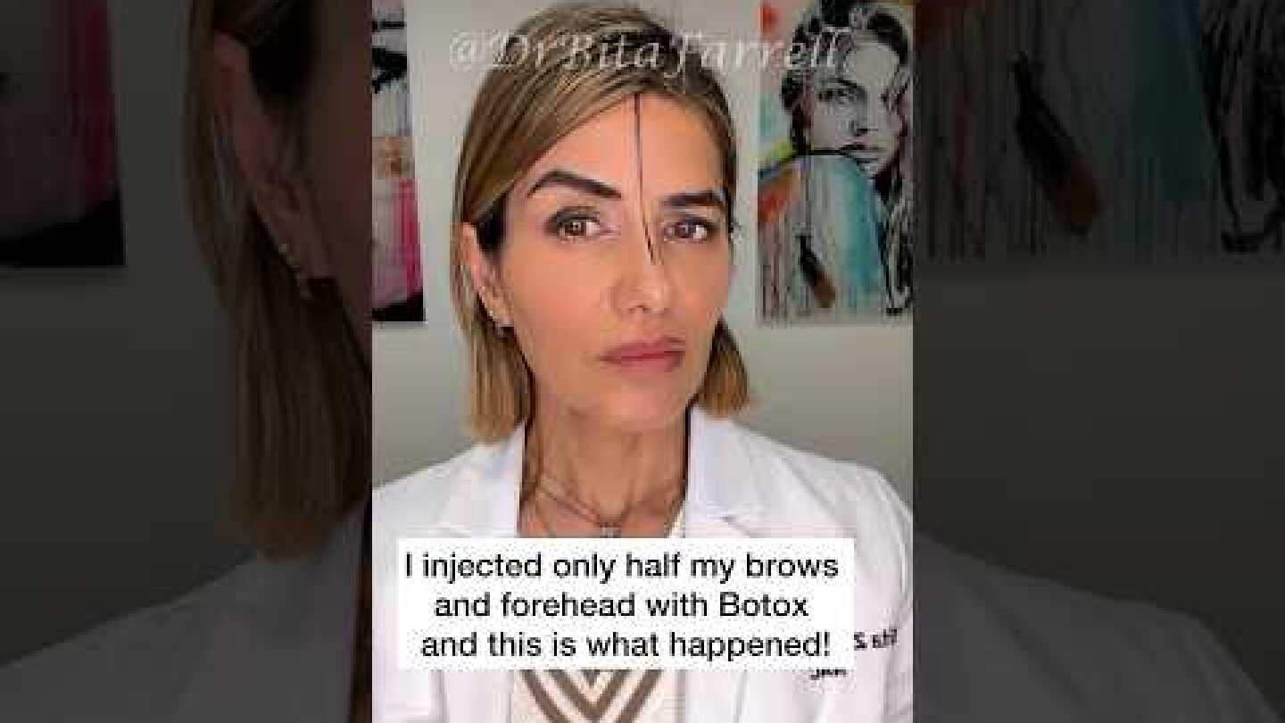 #browlift #botoxbrowlift #botoxtraining #browshaping #botox #botoxtraining #drbitafarrell