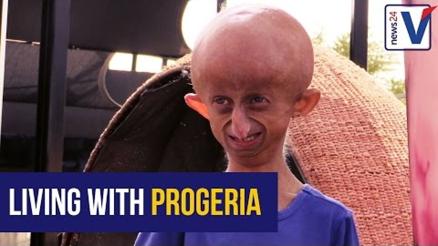 Living with Progeria: Walking in Beandri Booysen's shoes