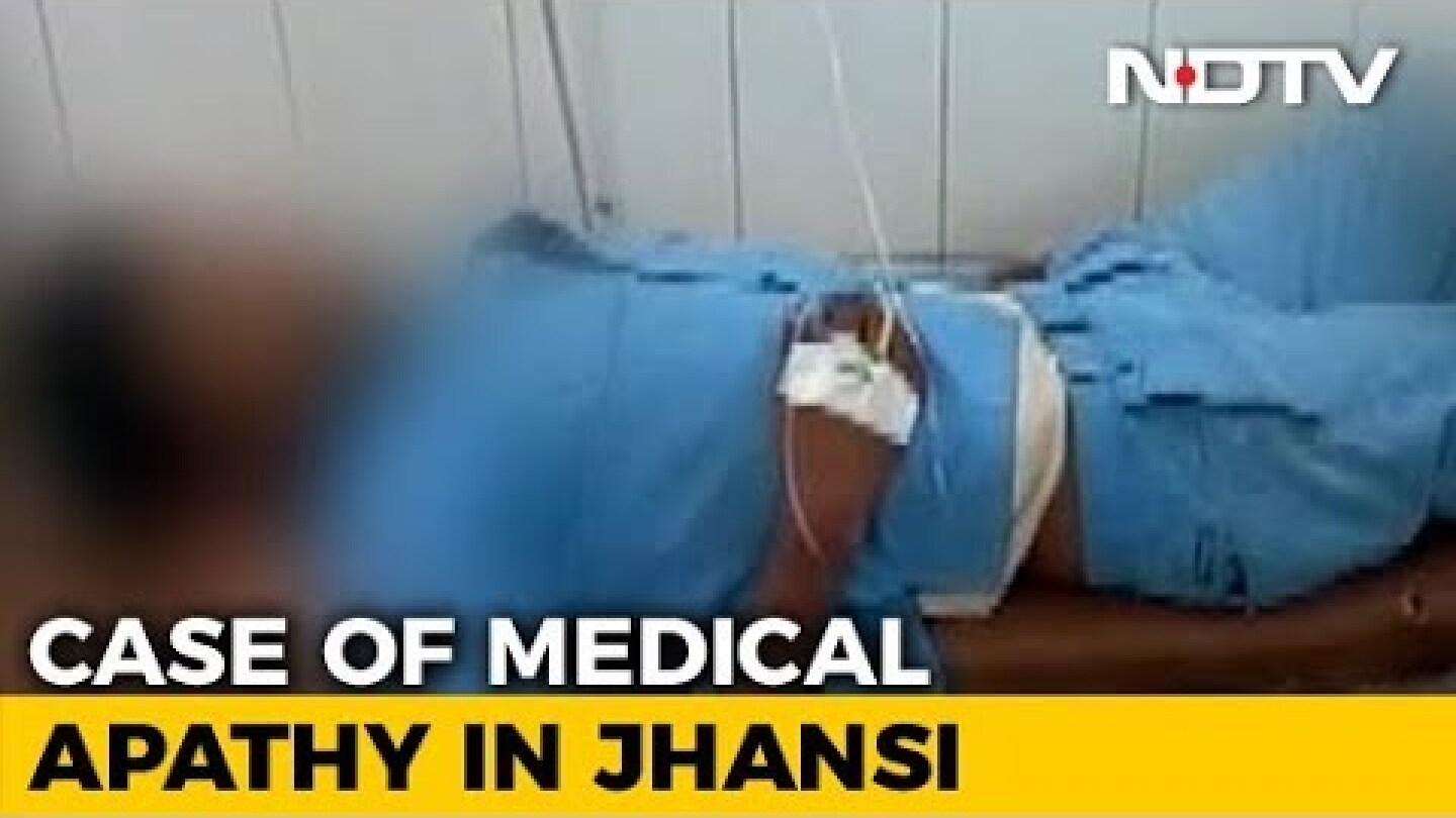 UP Doctors Allegedly Use Man's Severed Foot As Headrest After Surgery