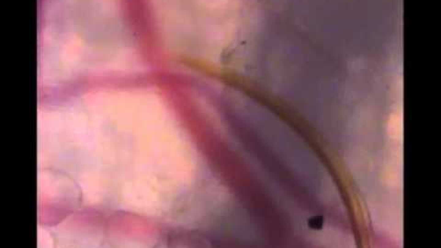Mosquito finds blood vessel