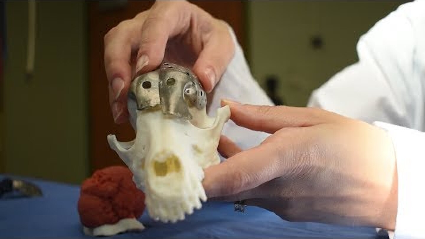 How 3-D-Printed Skull Plates Are Revolutionizing Surgery